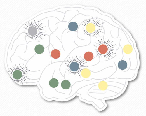 Music & the Brain Graphic